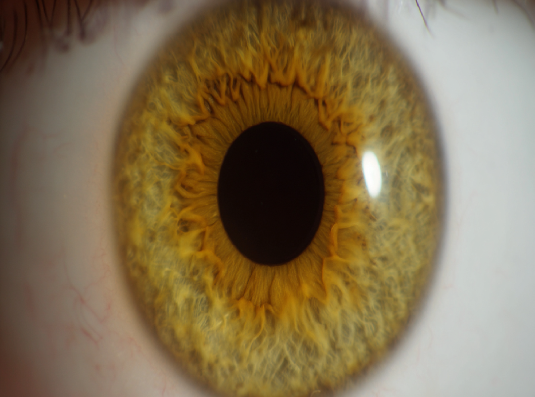 Механическая желтуха