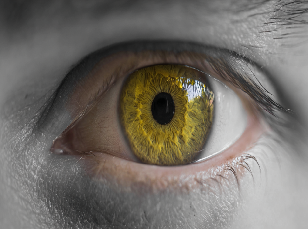 Механическая желтуха