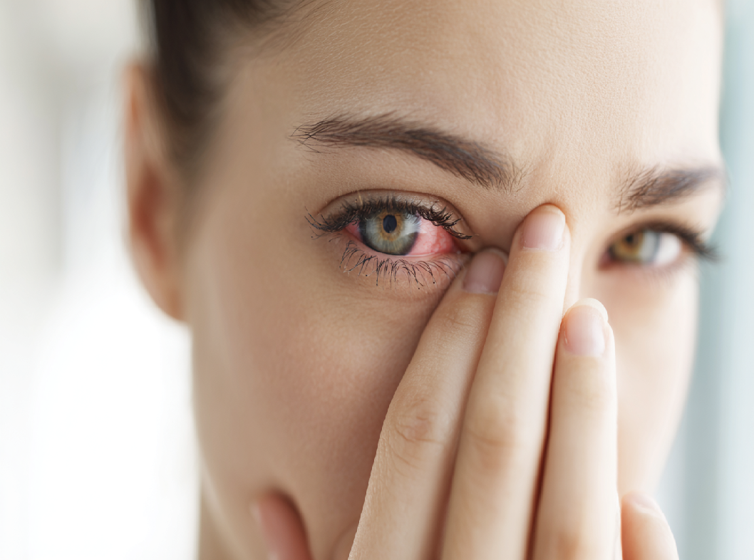 Дакриоцистит