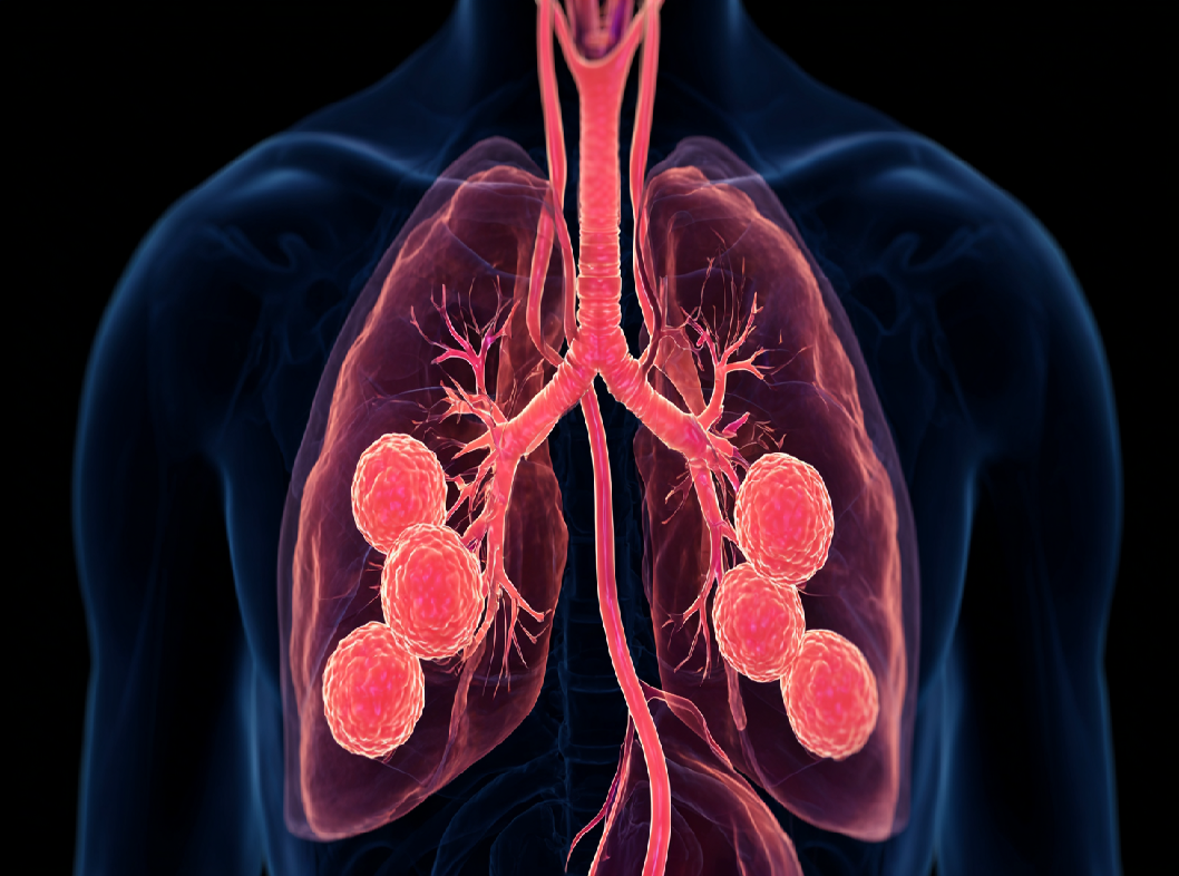 Гиперосмолярный синдром