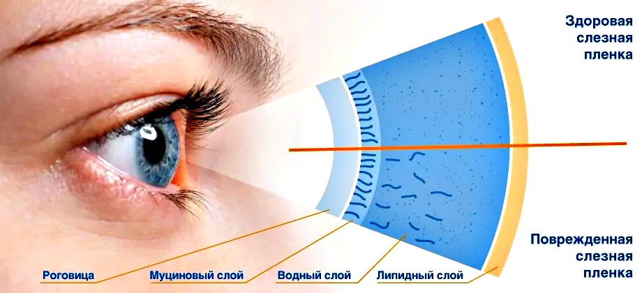 диагностика синдрома