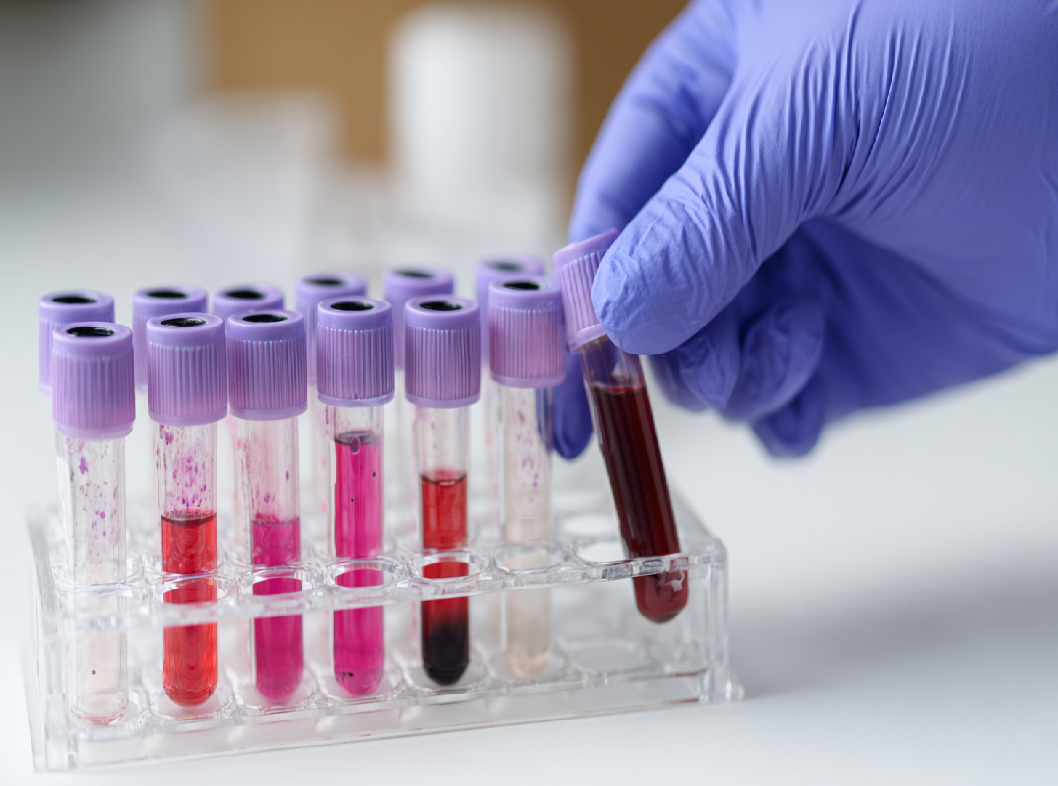 Анализ на гепатит C