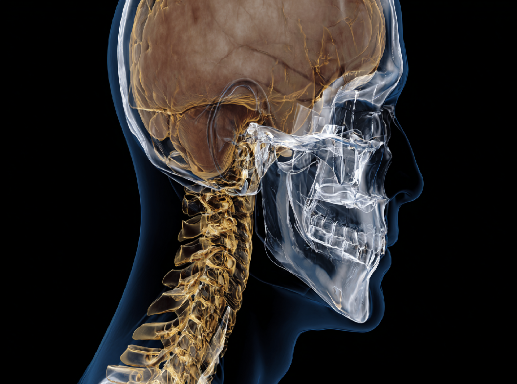 Синдром черепно-шейного перекоса