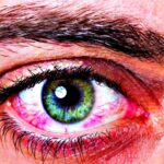 Синдром сухого глаза Arimed
