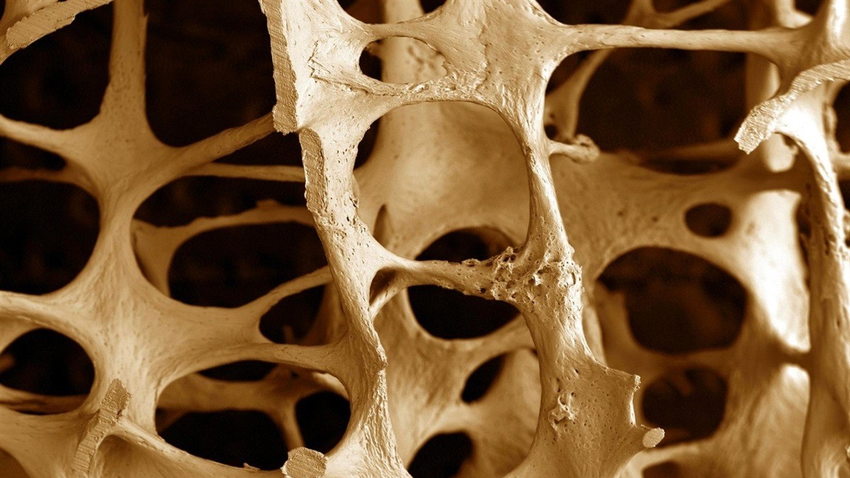 Генетическая предрасположенность к остеопорозу