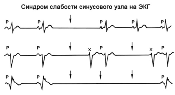 сссу