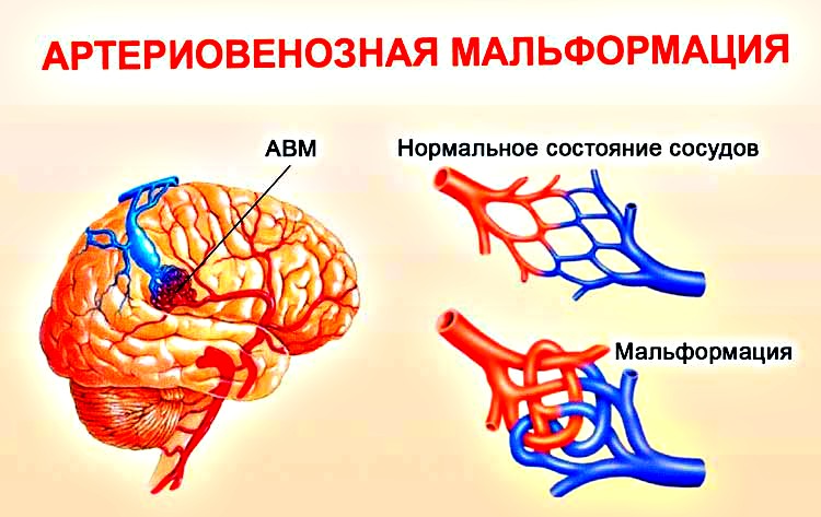причины возникновения