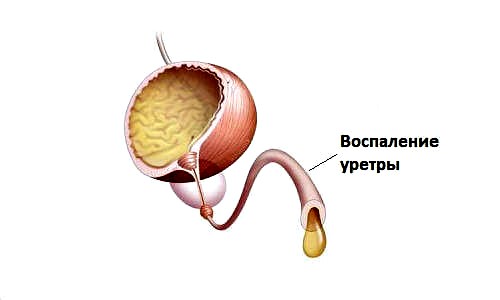 дополнительная симптоматика