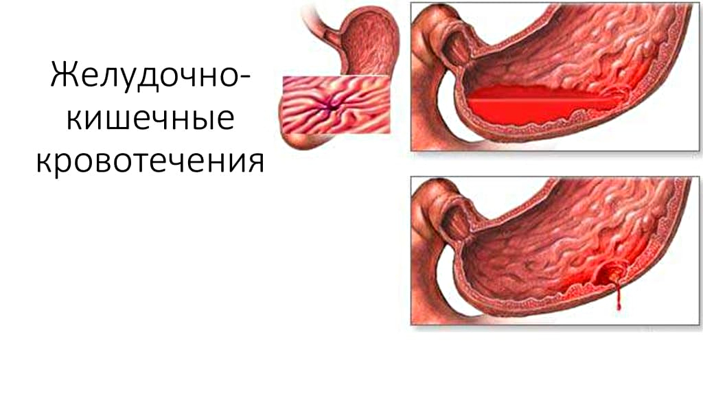 Почему повышаются тромбоциты