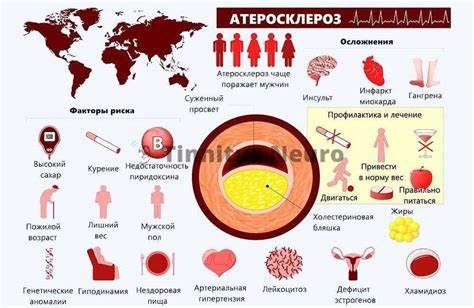 Атеросклероз