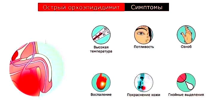 симптомы орхоэпидидимита
