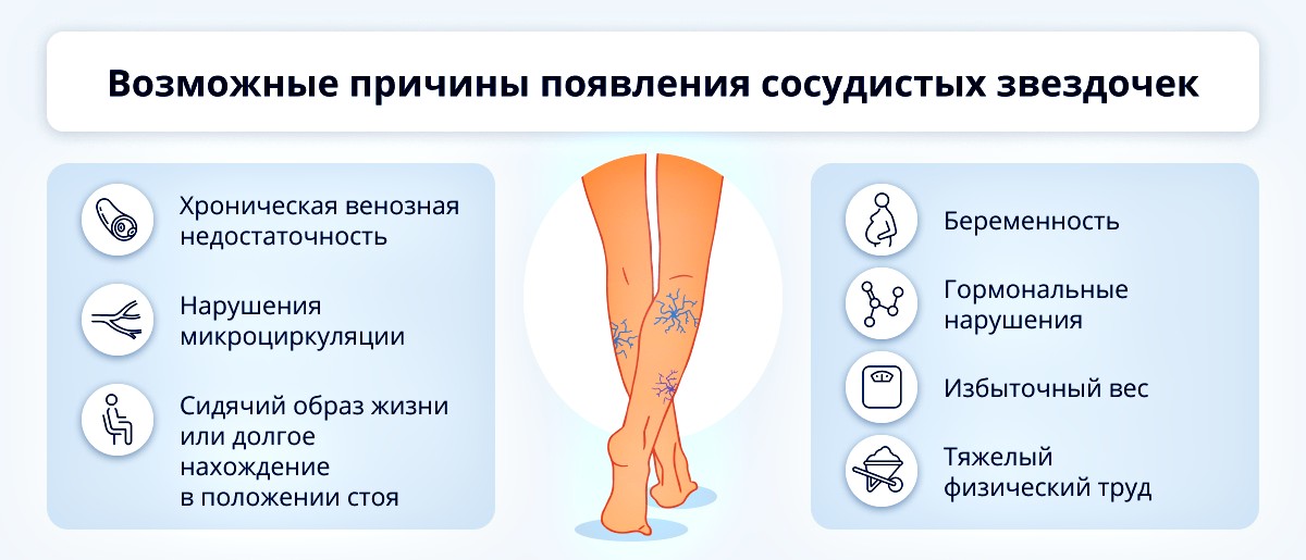 причины сосудистой сеточки