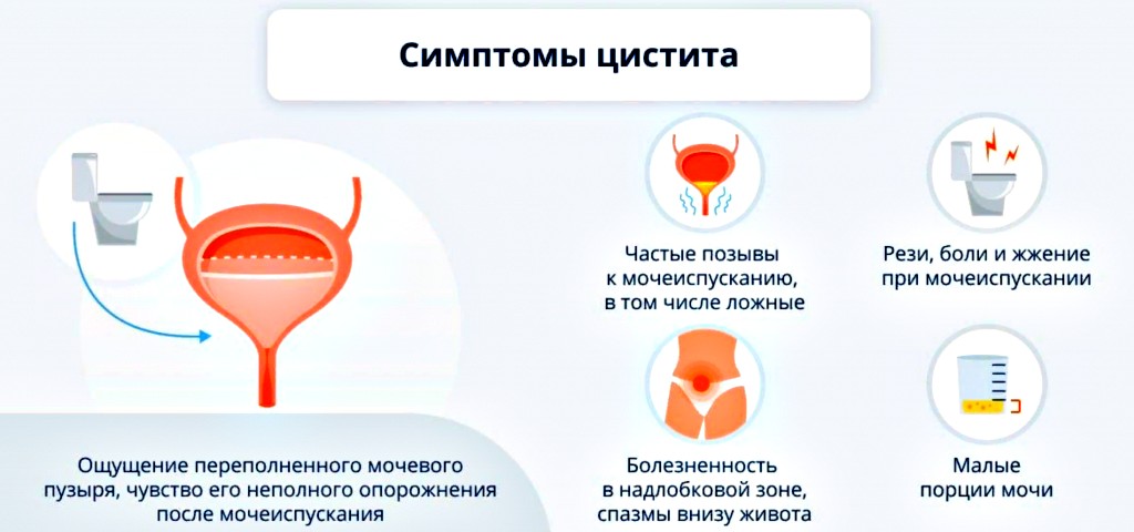 симптомы цистита