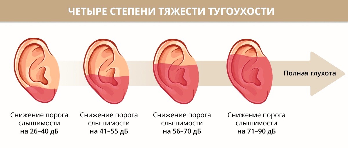 тугоухость