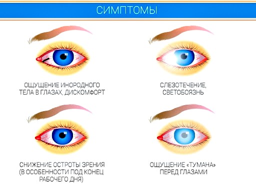 симптомы синдрома