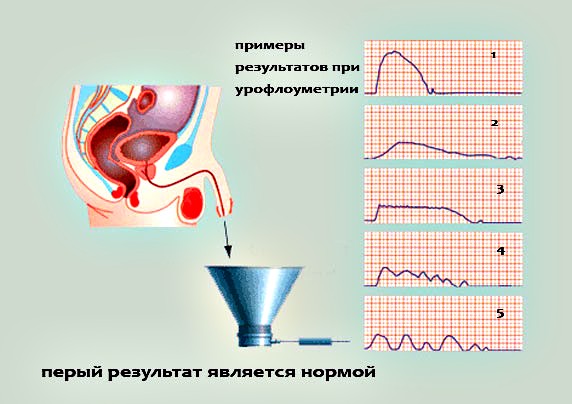 диагностика 
