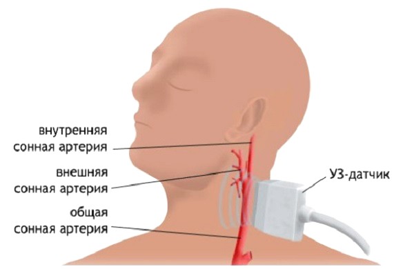 уздс шеи