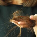 Почему выпадают волосы Arimed