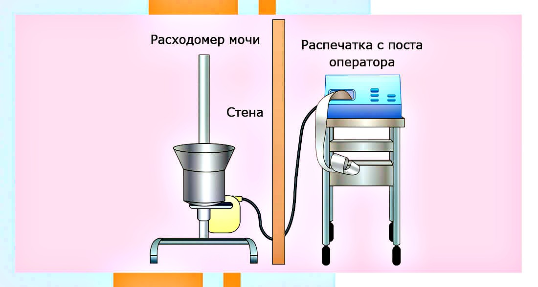 проведение урофлоуметрии