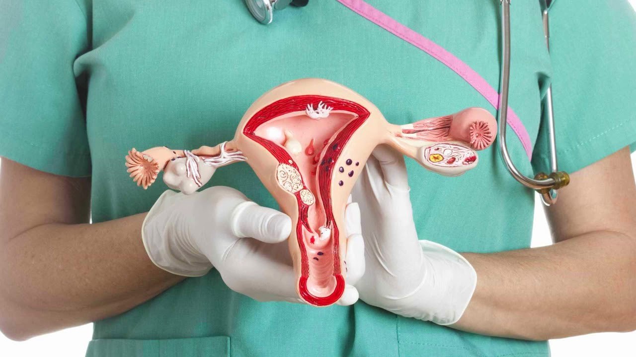 Check-up репродуктивная система для женщин