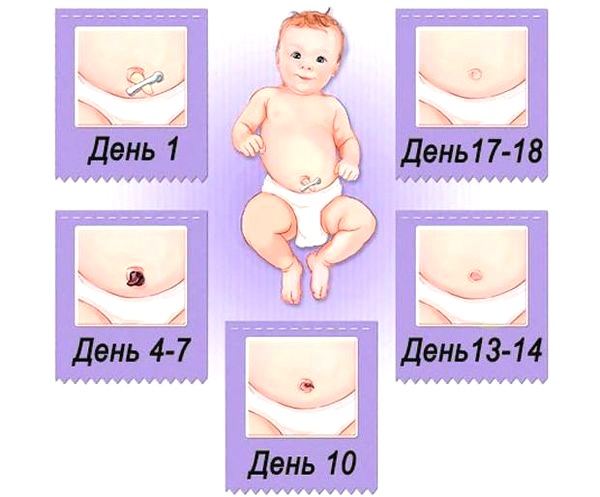 омфалит
