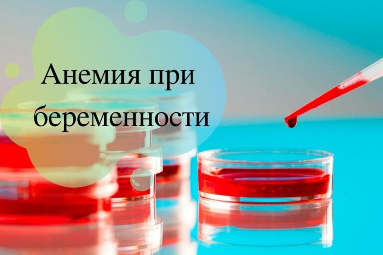 Анемия при беременности Arimed