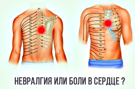 боль в сердце причины