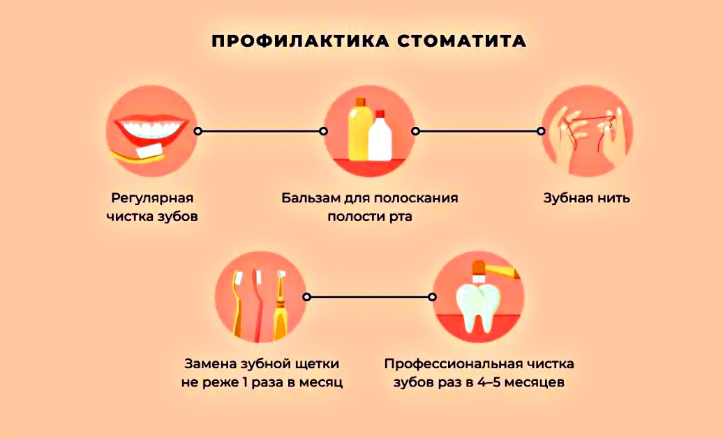 профилактика стоматита