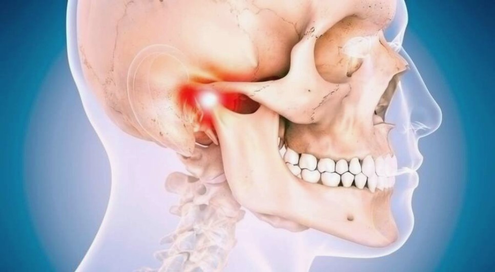 Остеорадионекроз челюстно-лицевых костей