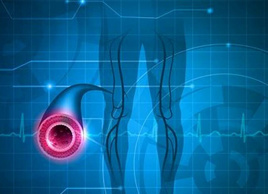 Периферическая артериальная болезнь