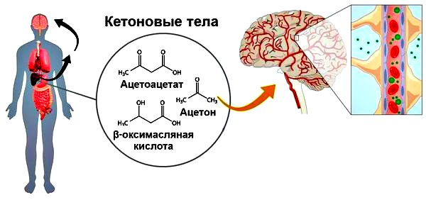 причины комы