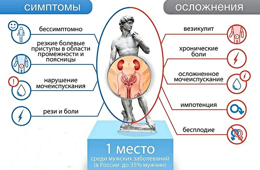 Аденома предстательной железы