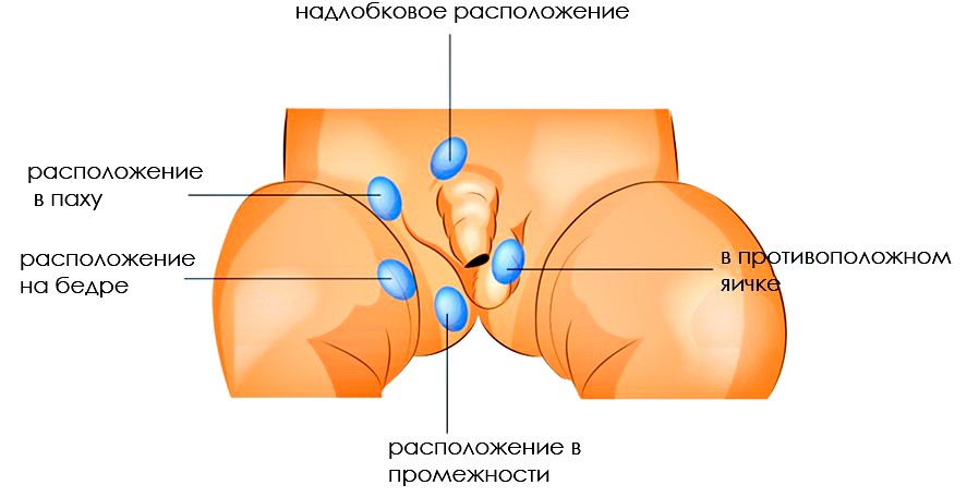 симптомы заболевания