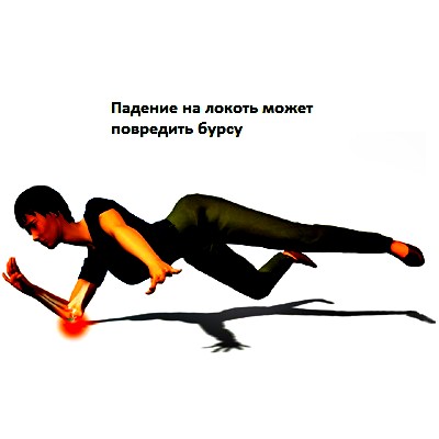 травма локтя
