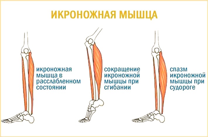 сводит мышцы