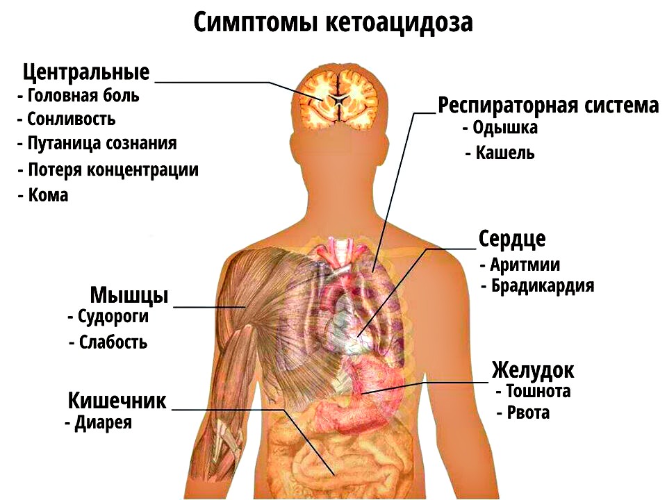 симптомы комы