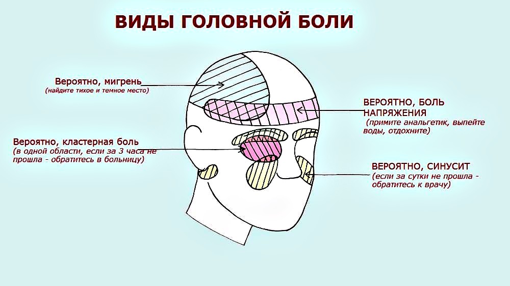 виды головной боли