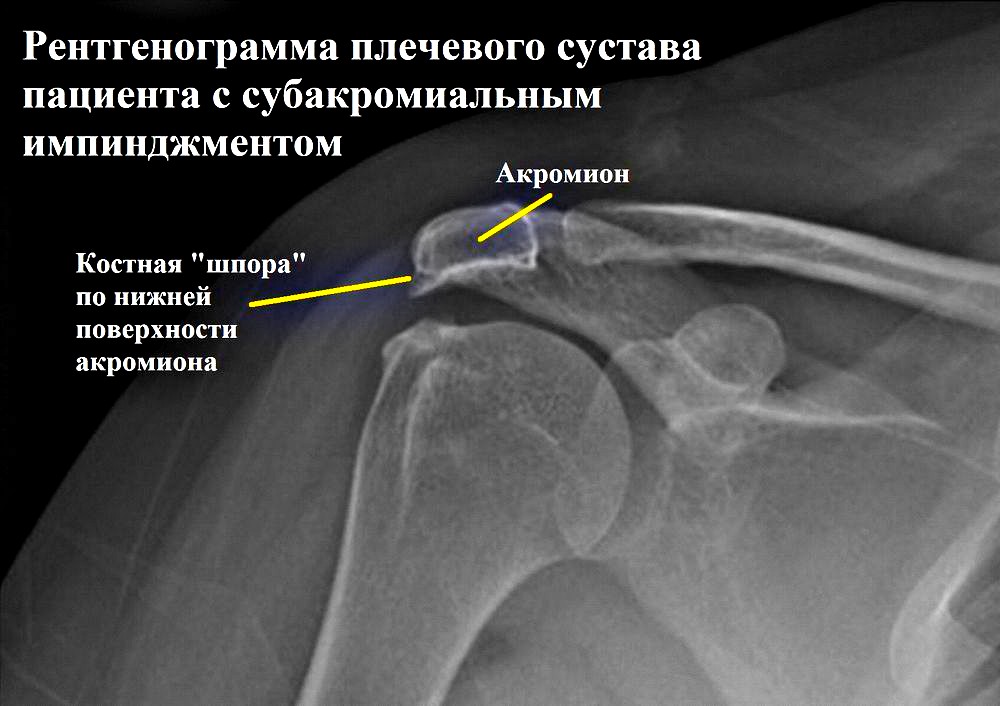 диагностика синдрома