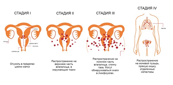 шм