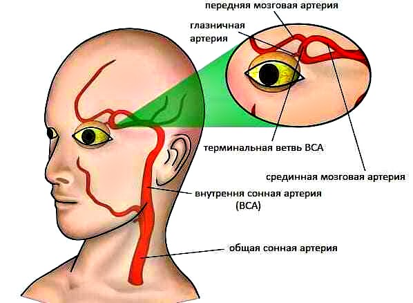 причины глазной мигрени