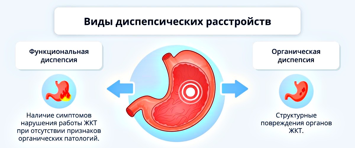 виды диспепсии