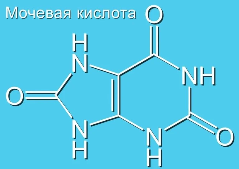 повышенная мочевая кислота