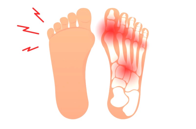 Боль в суставах пальцев ног Arimed