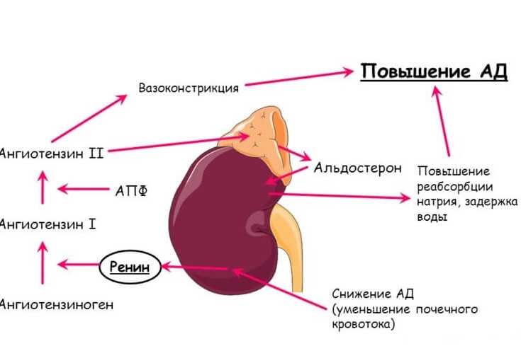 гиперальдостеронизм