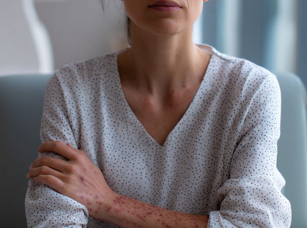 Реактивный гепатит симптомы