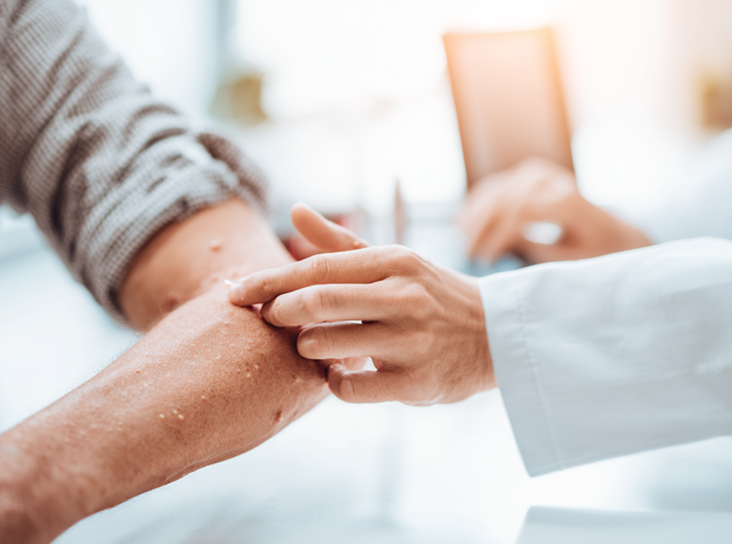 Диагностика папилломы