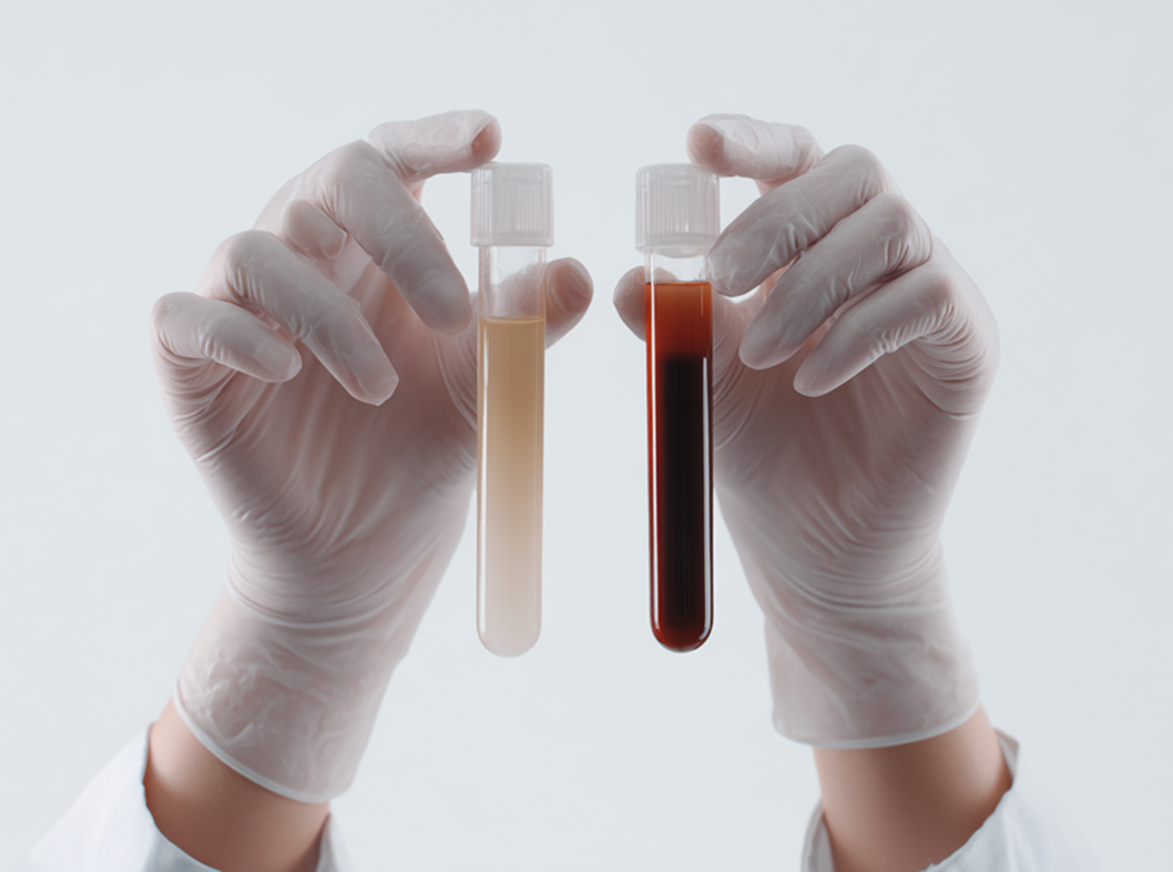 Симптомы галактореи