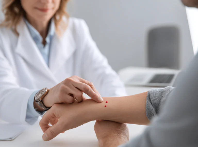 Пиогенная гранулема кожи