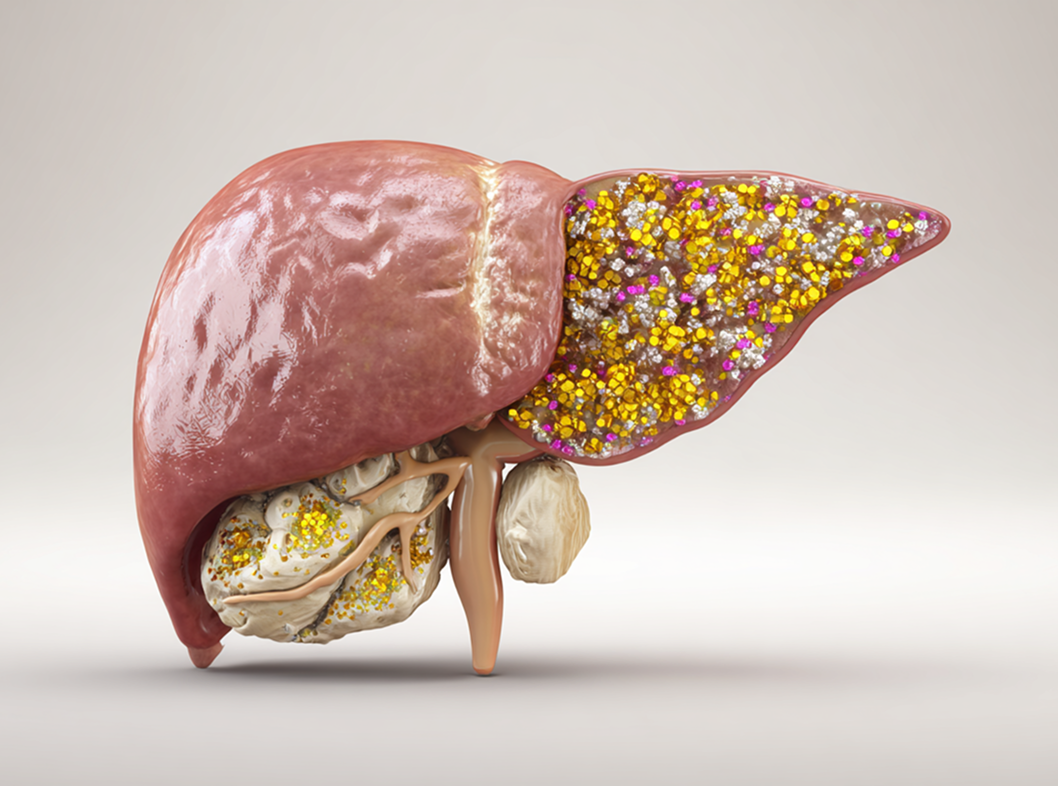Печеночная недостаточность: причины, симптомы и лечение